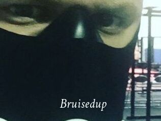 Bruisedup