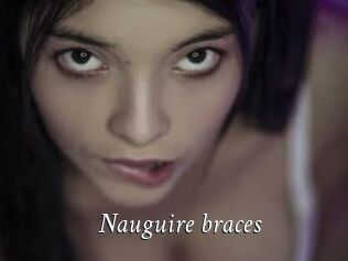 Nauguire_braces